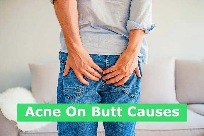 Acne On Butt Causes