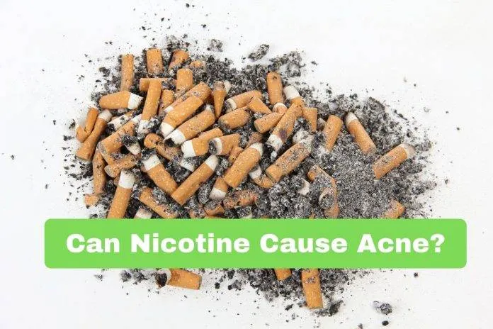 Can Nicotine Cause Acne?