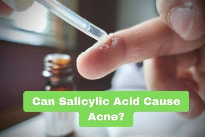 Can Salicylic Acid Cause Acne?