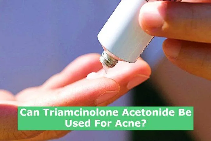 Can Triamcinolone Acetonide Be Used For Acne?