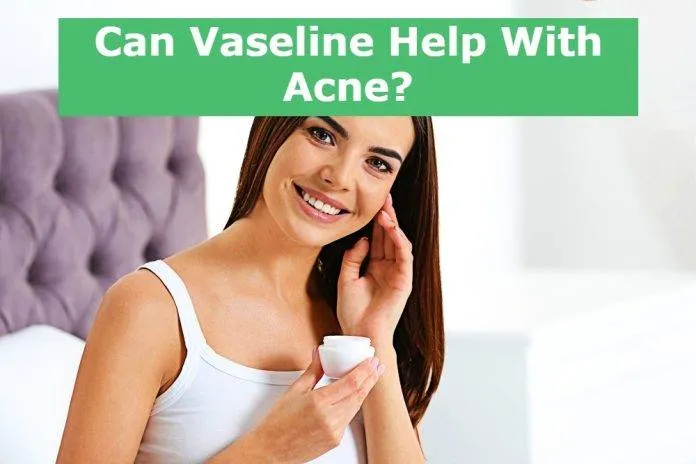 Can Vaseline Help With Acne?