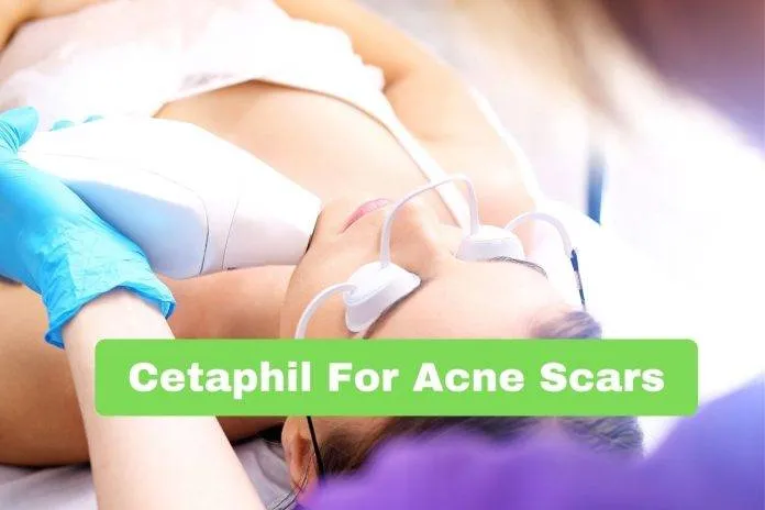 Cetaphil For Acne Scars