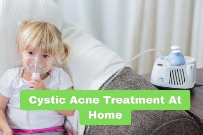 Cystic Acne Treatment At Home