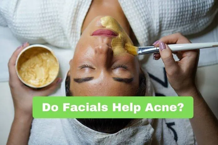 Do Facials Help Acne?
