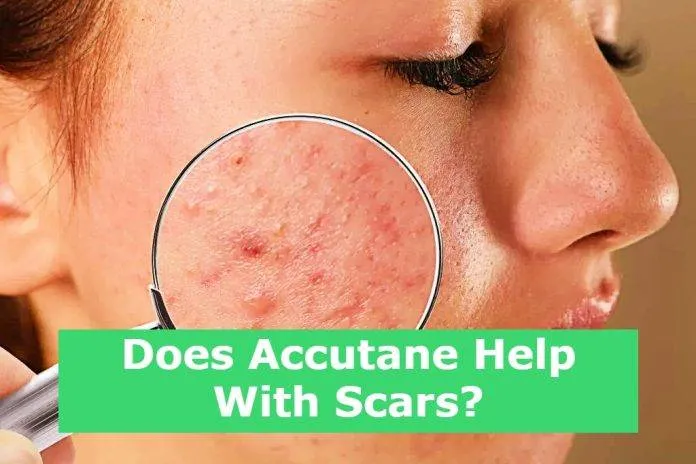 Does Accutane Help With Scars?