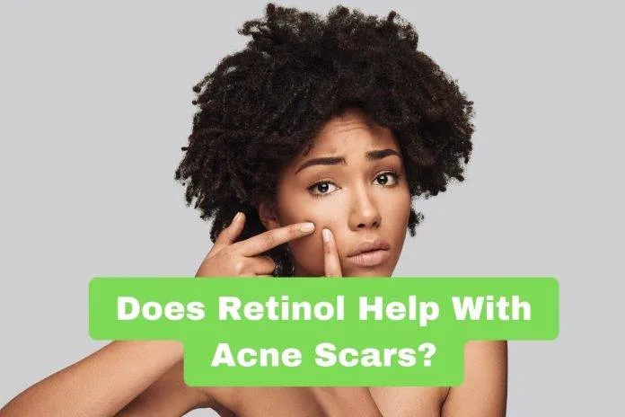Does Retinol Help With Acne Scars?