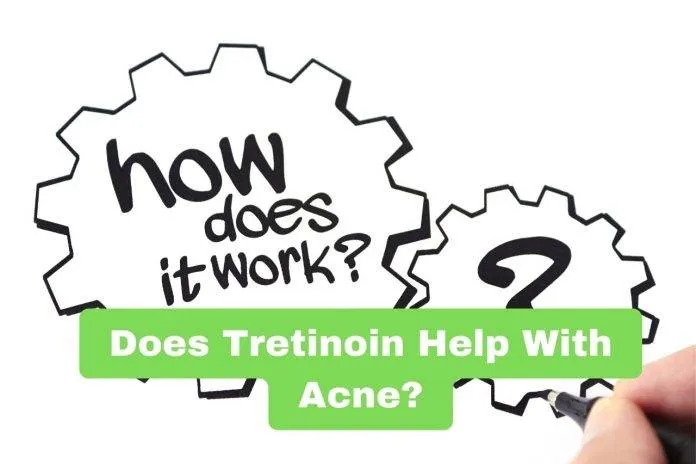 Does Tretinoin Help With Acne?