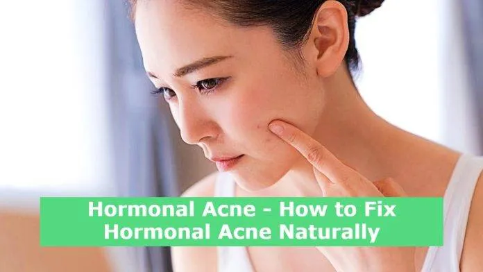 Hormonal Acne - How to Fix Hormonal Acne Naturally