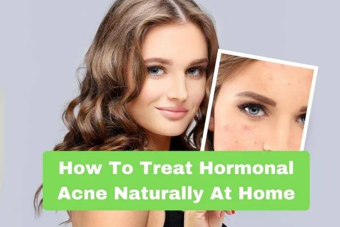 How To Treat Hormonal Acne Naturally At Home