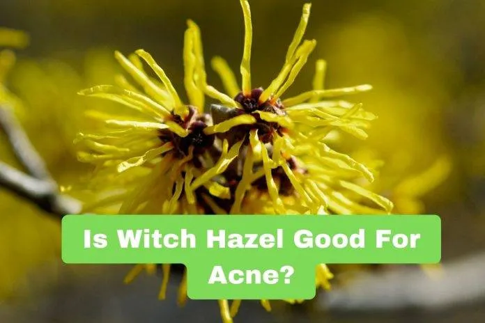 Is Witch Hazel Good For Acne?