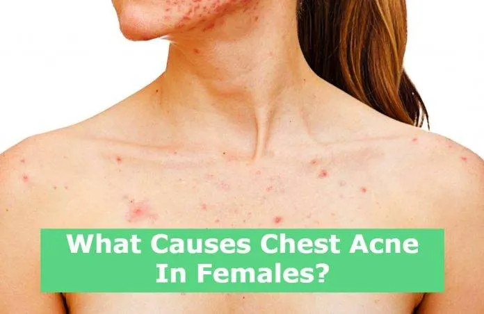 What Causes Chest Acne In Females?