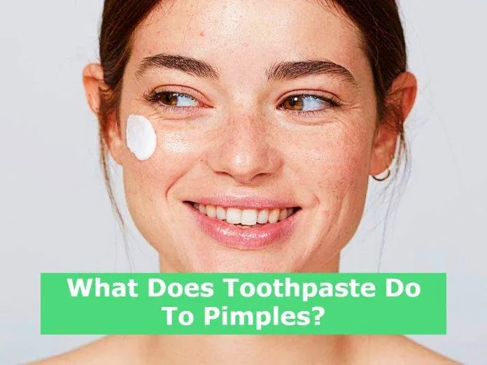 What Does Toothpaste Do To Pimples?