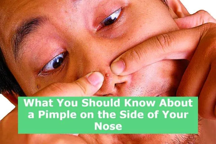 What You Should Know About a Pimple on the Side of Your Nose