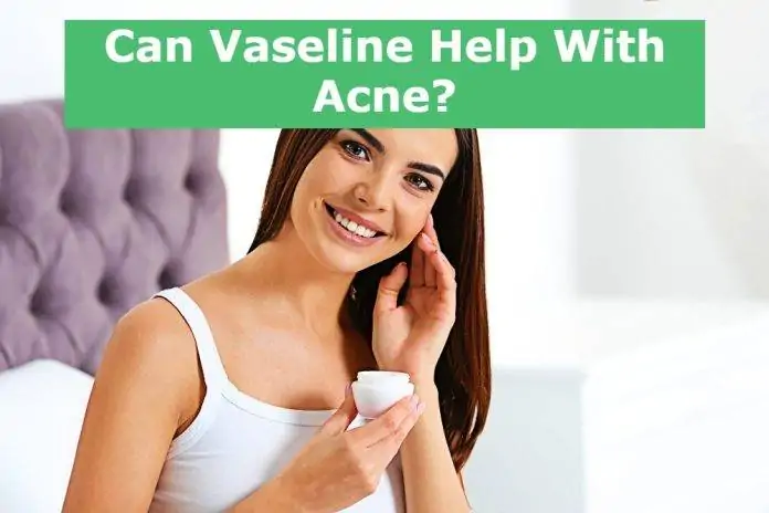 Can Vaseline Help With Acne Can Vaseline Help With Acne?