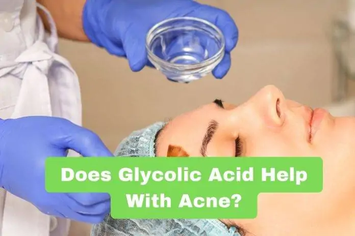Does Glycolic Acid Help With Acne?