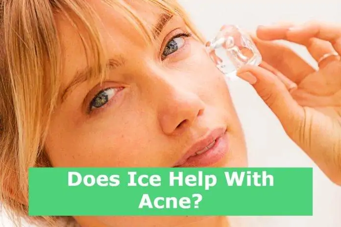 Does Ice Help With Acne?