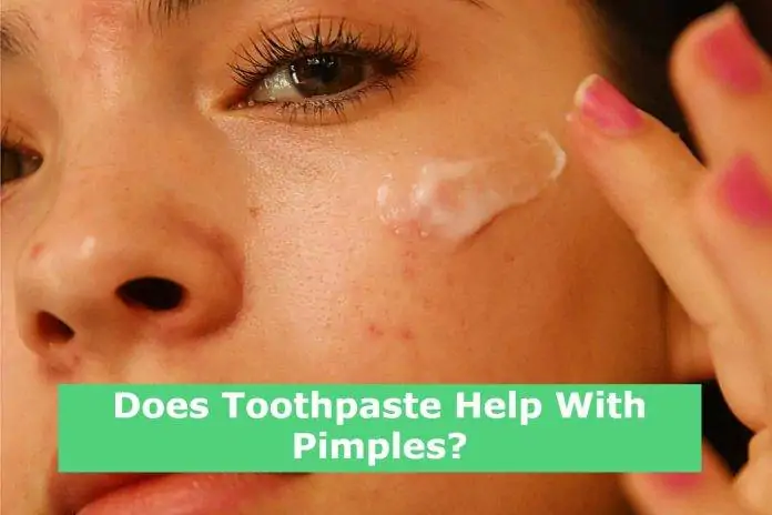 Does Toothpaste Help With Pimples?