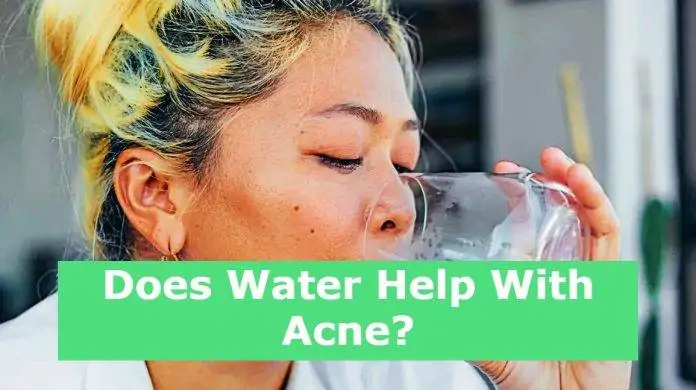 Does Water Help With Acne?