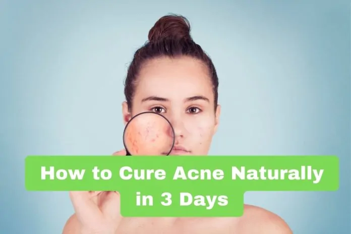 How to Cure Acne Naturally in 3 Days