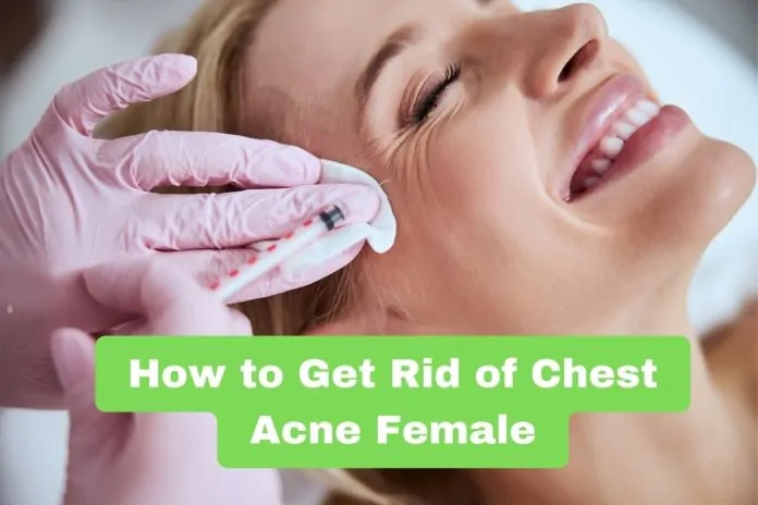 How to Get Rid of Chest Acne Female How to Get Rid of Chest Acne Female