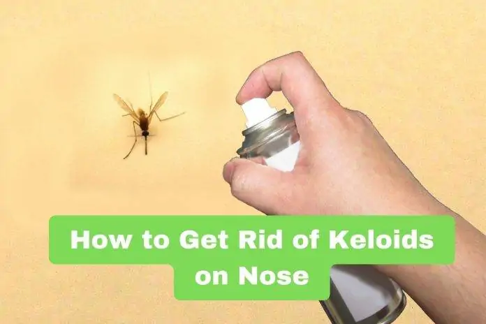 How to Get Rid of Keloids on Nose