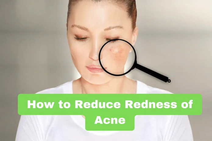 How to Reduce Redness of Acne