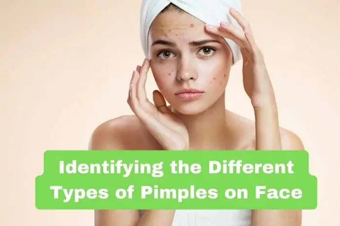 Identifying the Different Types of Pimples on Face