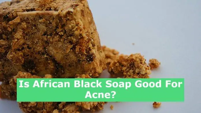 Is African Black Soap Good For Acne?