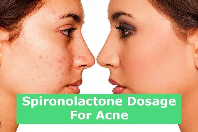 Spironolactone Dosage For Acne