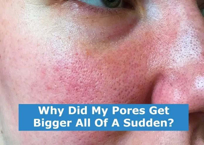 Why Did My Pores Get Bigger All Of A Sudden?